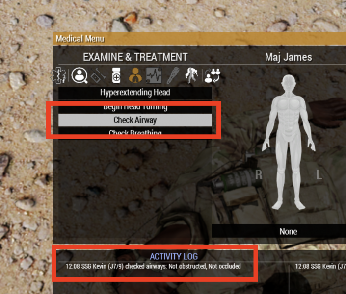 The location of the "Check Airway" action and the result as seen in the activity log