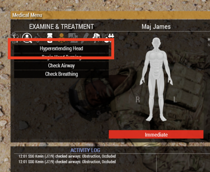 Action as seen in the medical menu